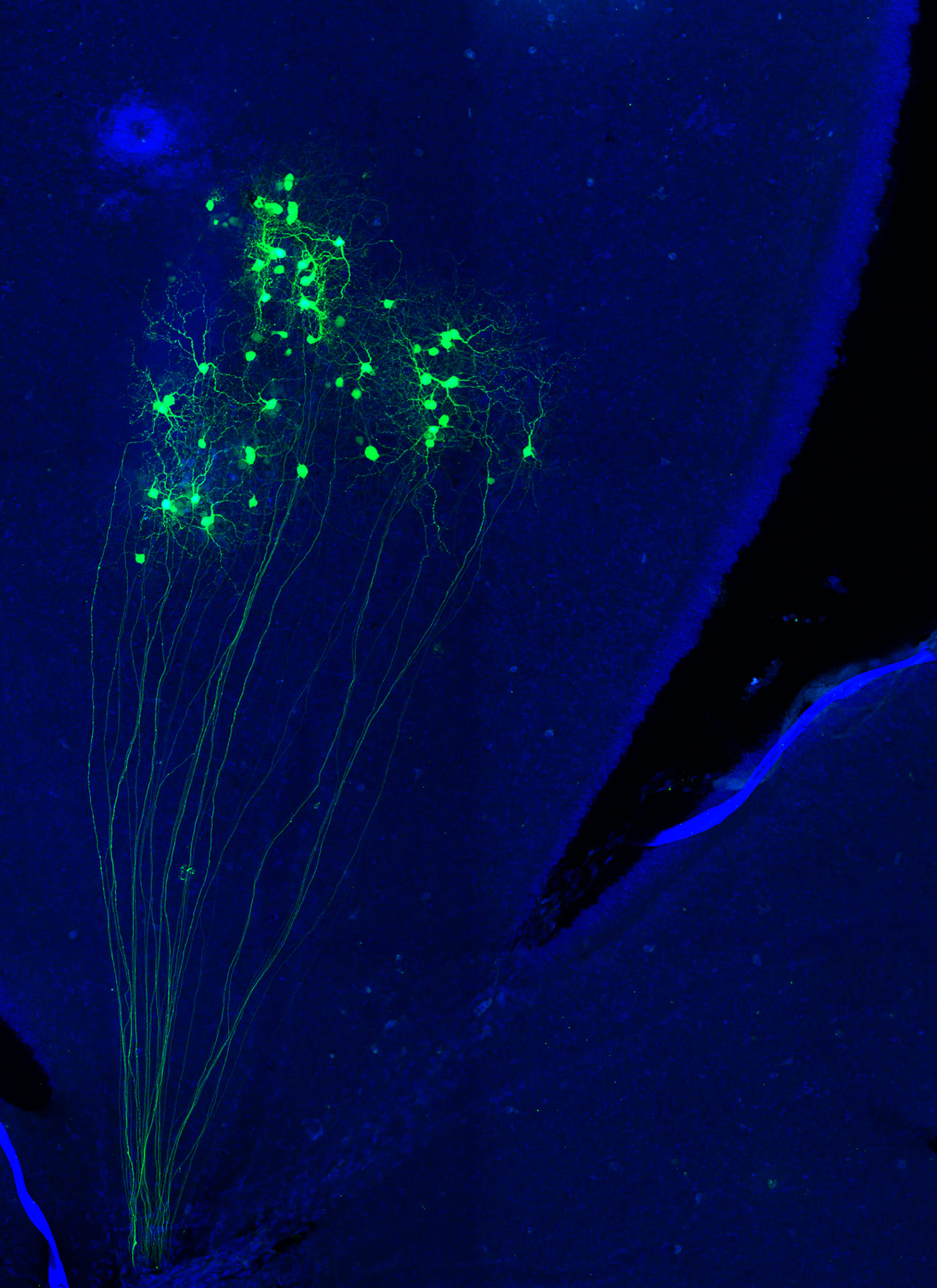 "Constelación". Edición: FOTCIENCIA19. Autoría: Verónica Murcia-Belmonte. En la imagen, se muestran un conjunto de células ganglionares de la retina marcadas con GFP (en verde) y sus respectivos axones, que continuarán su viaje a través del nervio óptico hasta llegar a los principales centros visuales del cerebro