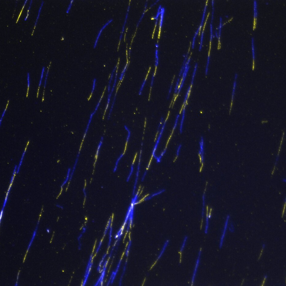 En la imagen se muestran, a través de un microscopio de fluorescencia, fibras de ADN estiradas y marcadas. Esta técnica se utiliza para estudiar el patrón replicativo de las células. Cuando una célula está replicando su ADN, esa pieza se incorpora en la hebra naciente; luego podemos detectarla por immunofluorescencia, en amarillo en la foto. En azul, una tinción general del ADN con el uso de un anticuerpo fluorescente que reconoce ADN de cadena sencilla.