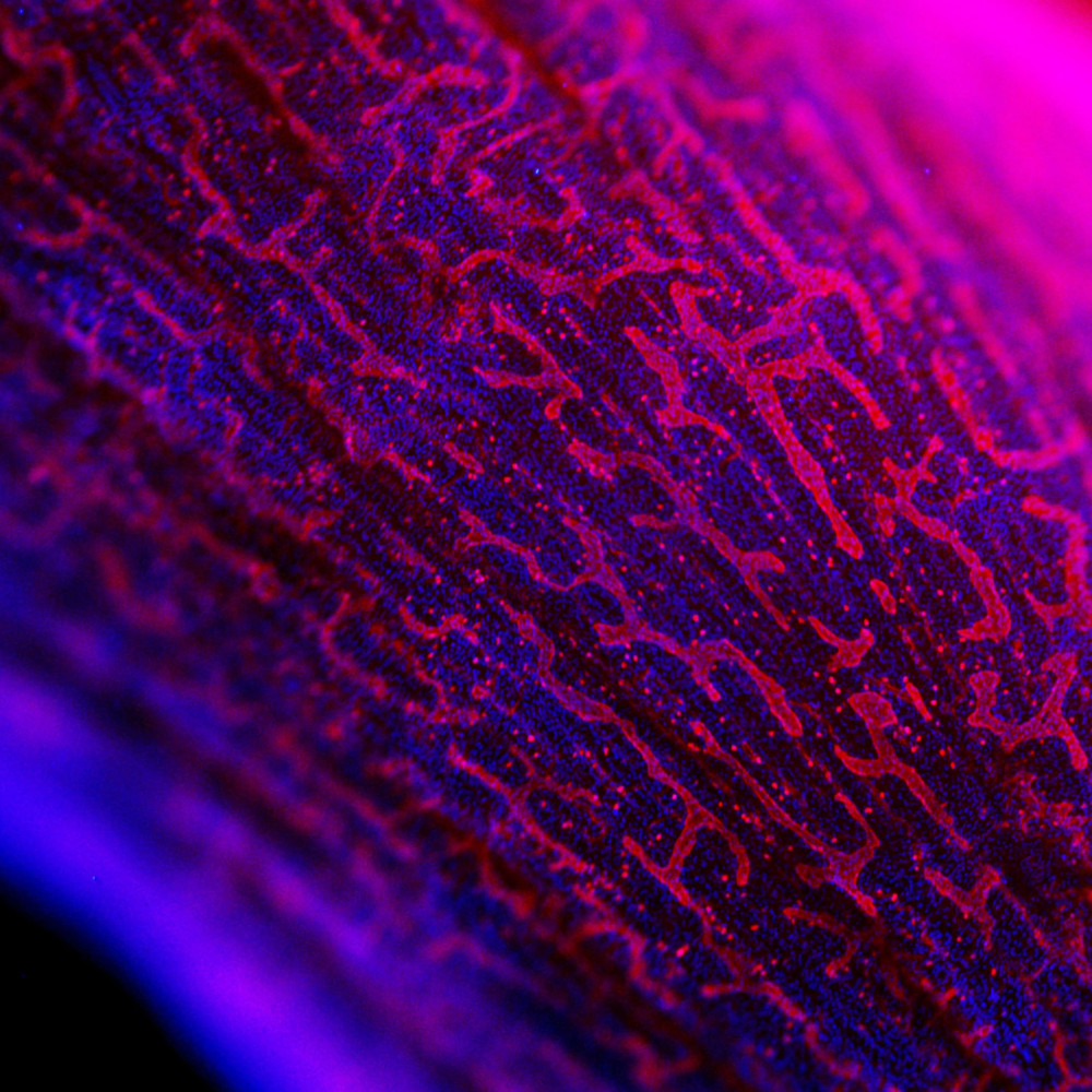 En la imagen se observan los cuernos uterinos de un ratón vistos bajo el microscopio. Se ven los vasos linfáticos en color rojo. 