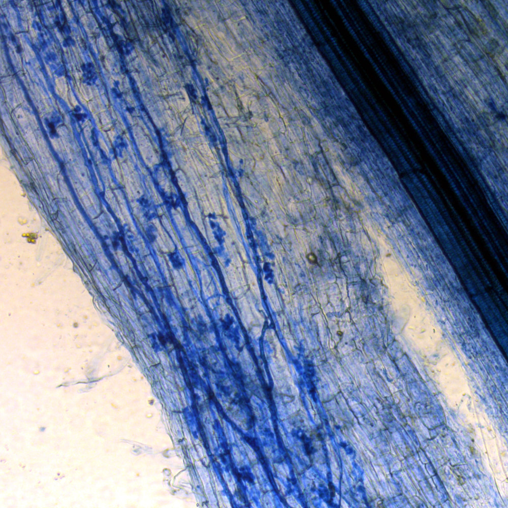 The photo shows, magnified by 100, a lettuce root dyed with trypan blue. In a dark blue diagonal, the vessel that carries water to all parts of the plant stands out. Below, in more intense blue, the characteristic structures of a mycorrhizal fungus can be seen.