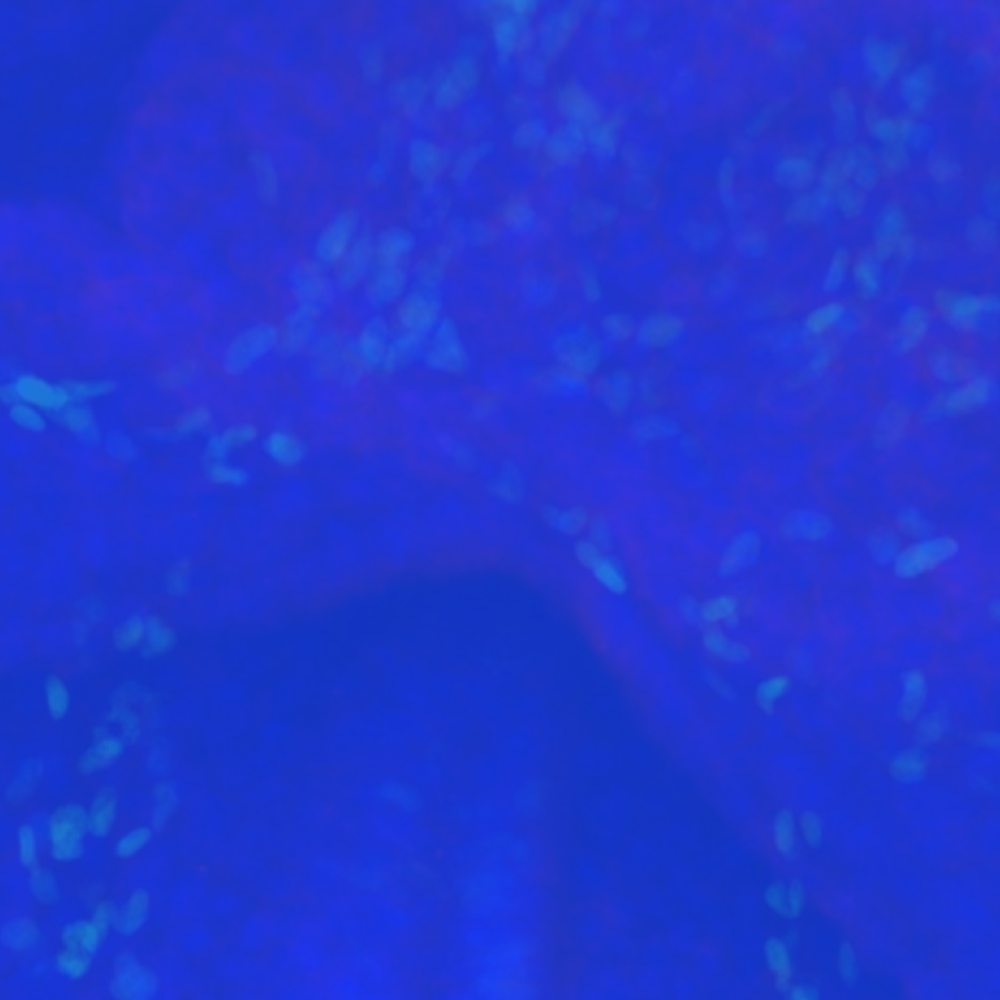 "" ""